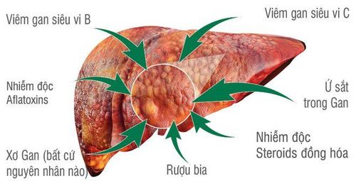 
Các nguyên nhân gây ra bệnh lý gan.
