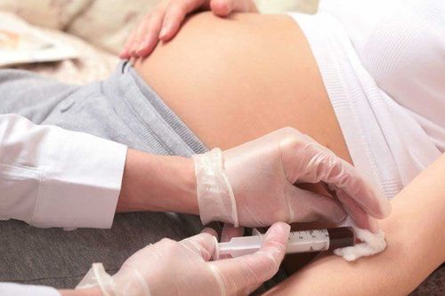 Does every pregnant woman need to do Triple test?