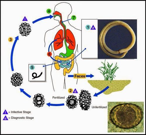 Roundworm disease: Causes, symptoms, and ways to prevent it