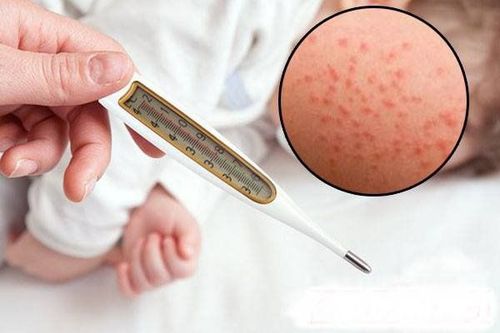 What are the symptoms of measles and how many days should be isolated to avoid spreading the disease?