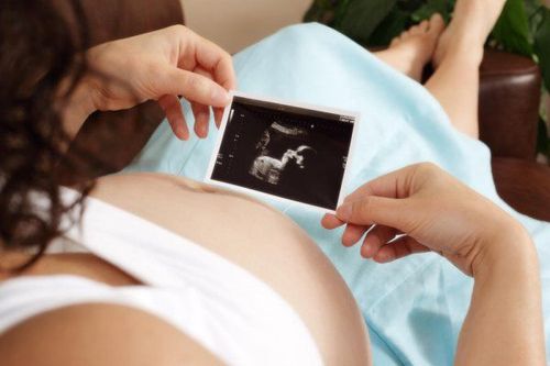 Is a 12-week ultrasound really necessary?