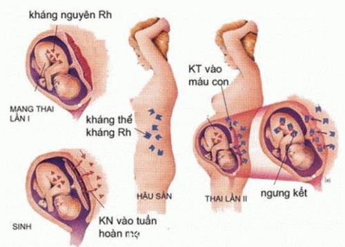 
Xét nghiệm máu nhằm phát hiện tình trạng bất đồng nhóm máu khi thai 12 tuần
