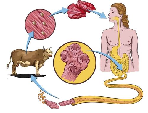 Phác đồ điều trị bệnh giun xoắn