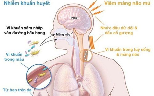 
Viêm màng não mô cầu lây qua đường hô hấp với các hạt nước bọt có nhiễm vi khuẩn não mô cầu của người bị bệnh
