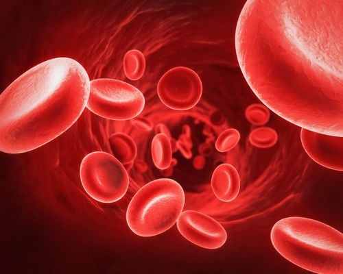 Bệnh đa hồng cầu cần điều trị thế nào và có thể sống được bao lâu?