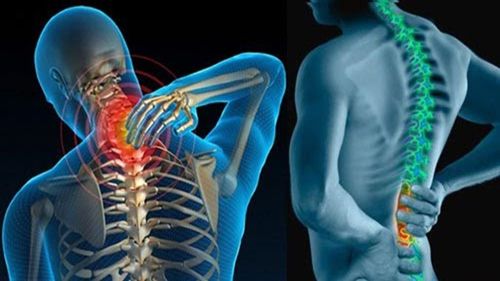 Can spinal stenosis be cured?