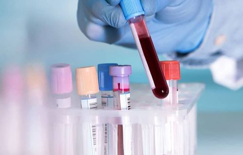 Why is it important to proactively take a general blood test to detect the disease?