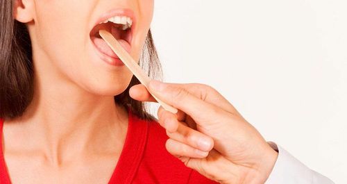 Nên làm gì khi bị xuất hiện vết chàm màu tím ở lưỡi?