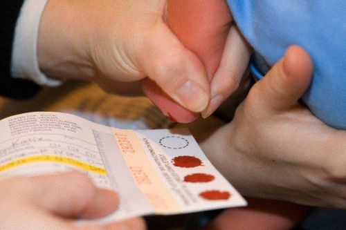 Newborn screening heel blood test