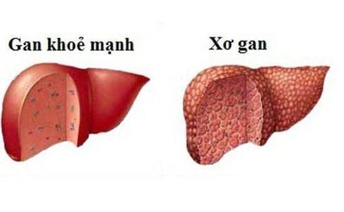 How to check liver function?