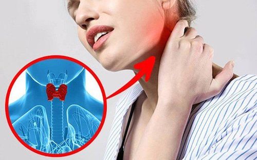 There are 10 signs, immediately think of thyroid disease