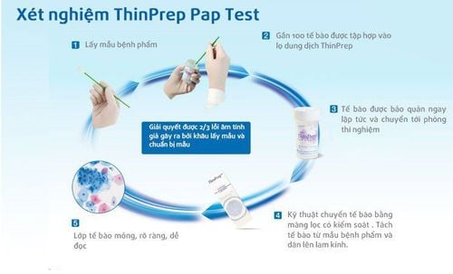 
Tóm tắt quy trình xét nghiệm Thinprep
