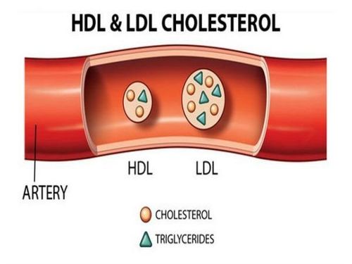 
Nồng độ cholesterol toàn phần HDL và LDL
