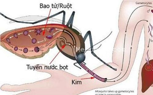 
Bệnh sốt xuất huyết Dengue là loại bệnh mắc phải khi nhiễm virus Dengue do muỗi Aedes aegypti truyền
