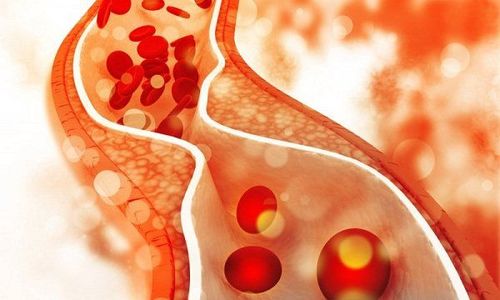 Cholesterol in the blood: Indicators you need to know