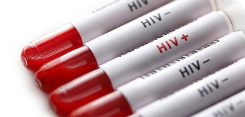 
Nếu nước bọt đơn thuần, khả năng lây nhiễm HIV gần như là không thể
