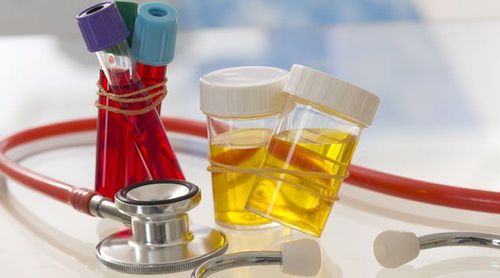 What is microscopic hematuria?