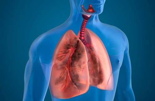 Treatment of acute exacerbation of chronic obstructive pulmonary disease