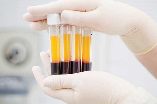 Aldosterone blood test