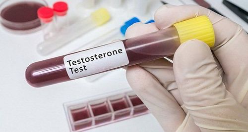 Determination of testosterone according to age