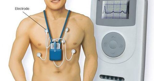 Holter điện tâm đồ là gì và có ý nghĩa thế nào trong chẩn đoán rối loạn nhịp tim?