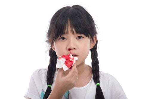 Nosebleeds in children and what you need to know