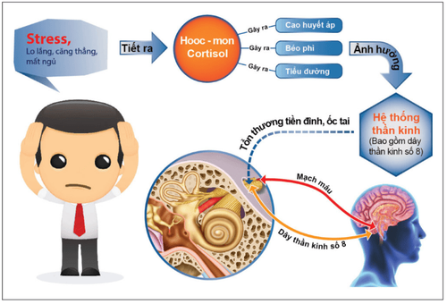 Rối loạn tiền đình có chữa khỏi được không