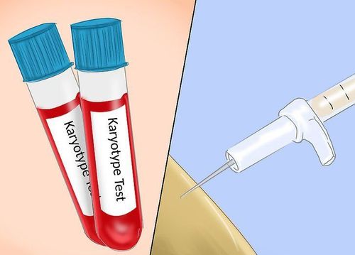 
Xét nghiệm Karyotype rất quan trọng xem xét kích thước, hình dạng và số lượng nhiễm sắc thể của bạn
