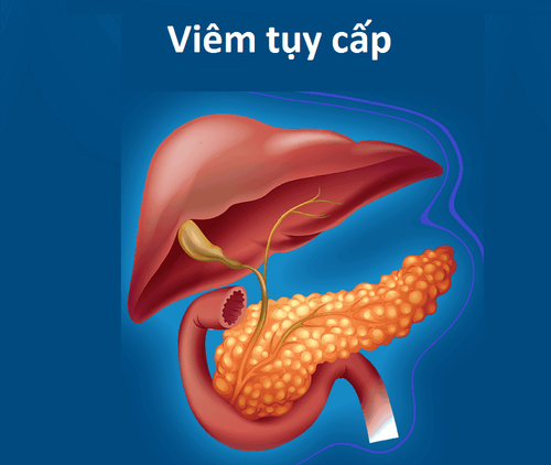 Chẩn đoán và điều trị bệnh viêm tụy cấp ở trẻ em thế nào?