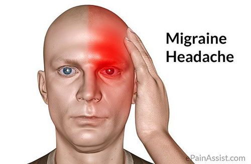 How dangerous is frequent, prolonged migraine?