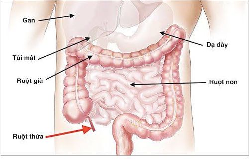 Vị trí thường thấy của ruột thừa. 