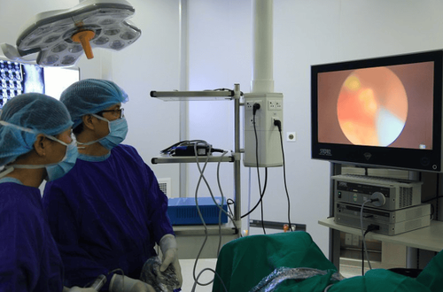 Retrograde endoscopic laser lithotripsy with flexible bronchoscope at Vinmec Hai Phong