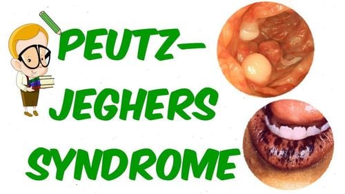 What is Peutz-Jeghers syndrome and how is it related to gastrointestinal cancer?