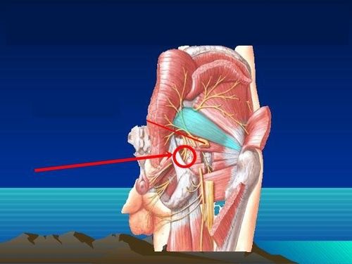 Anesthesia of the pudendal nerve - a solution to help relieve pain during childbirth at Vinmec