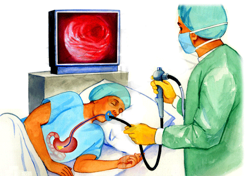 Emergency gastroesophageal endoscopy with high gastrointestinal bleeding for diagnosis and treatment