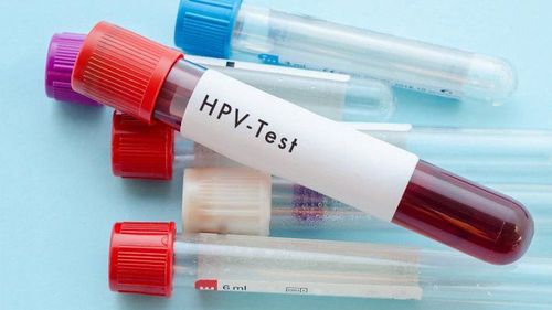 Do I need to be tested for HPV before getting the HPV vaccine?