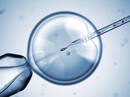 Learn about intracytoplasmic sperm injection (ICSI)