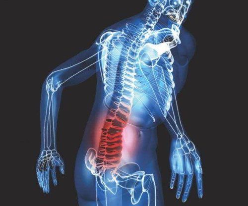 Ứng dụng của đồng vị phóng xạ trong điều trị giảm đau do ung thư di căn xương