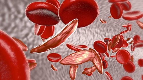 Bố hoặc mẹ mang gen thiếu máu thalassemia, thế hệ sau có thể mắc bệnh không?