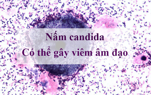 
Nấm Candida là nguyên nhân chính gây viêm âm đạo
