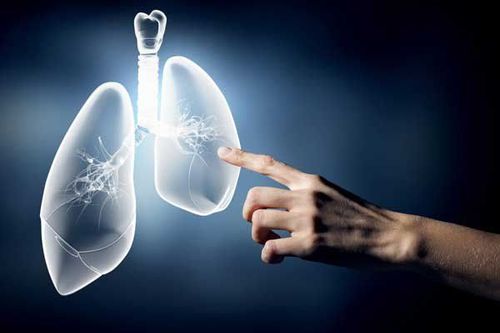 How is lung cancer diagnosed?