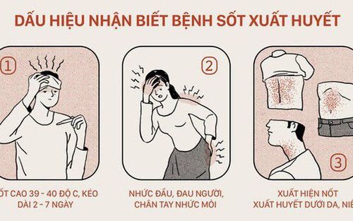 
Dấu hiệu của bệnh sốt xuất huyết
