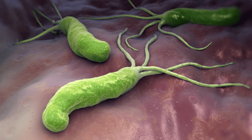 
Nhiễm vi khuẩn H. pylori trong dạ dày làm tăng nguy cơ bị ung thư dạ dày
