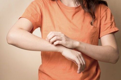 The warning signs of a shower gel allergy often first appear on the skin.