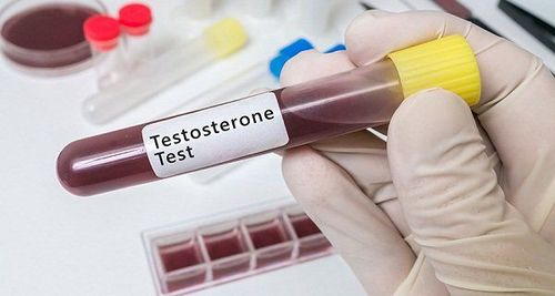 
Có nhiều nguyên nhân dẫn tới tình trạng thiếu hụt testosterone ở nam giới
