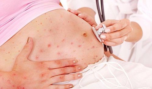 
Nếu bạn bị rubella khi mang thai có thể dẫn đến sảy thai
