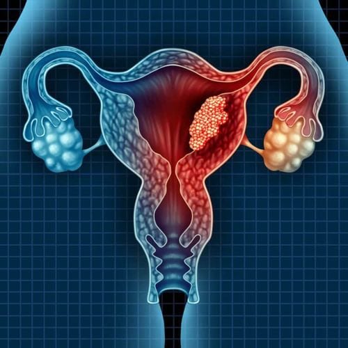 How many types of ovarian cysts are there and are they dangerous?