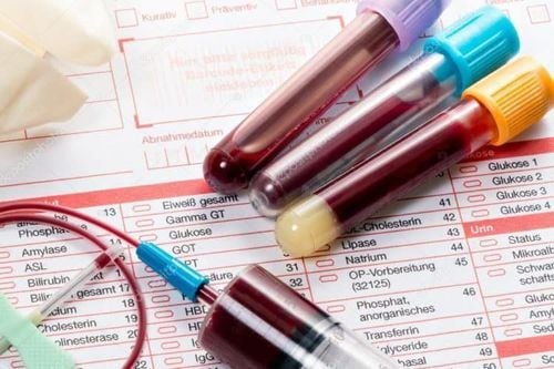 Significance of blood biochemical test indicators