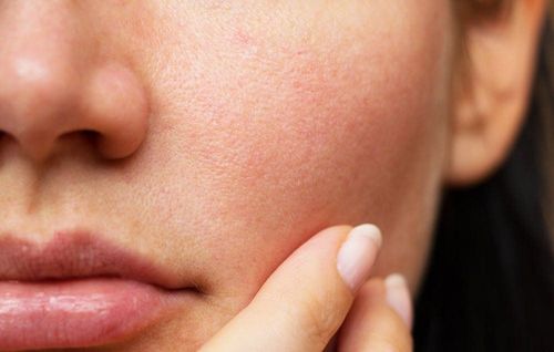 Why are pores getting bigger and bigger?