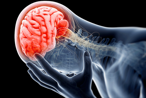 Injuries that occur immediately after a traumatic brain injury - Part 1